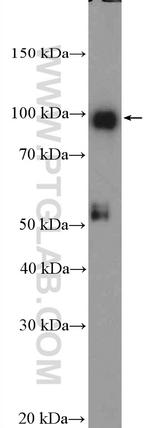 STRA6 Antibody in Western Blot (WB)