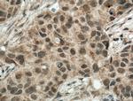 TBP Antibody in Immunohistochemistry (Paraffin) (IHC (P))