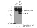 TBP Antibody in Immunoprecipitation (IP)