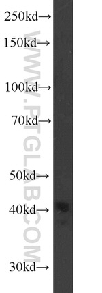 TBP Antibody in Western Blot (WB)