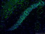 EGR1 Antibody in Immunohistochemistry (PFA fixed) (IHC (PFA))