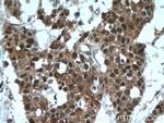 SAMD14 Antibody in Immunohistochemistry (Paraffin) (IHC (P))