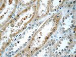 SAMD14 Antibody in Immunohistochemistry (Paraffin) (IHC (P))