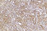 SAMD14 Antibody in Immunohistochemistry (Paraffin) (IHC (P))