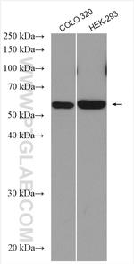 SAMD14 Antibody in Western Blot (WB)