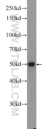 SAMD14 Antibody in Western Blot (WB)