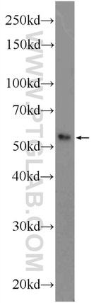 SAMD14 Antibody in Western Blot (WB)