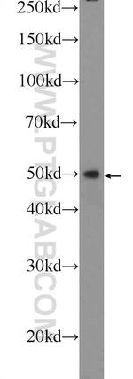 SAMD14 Antibody in Western Blot (WB)