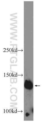 PHF20 Antibody in Western Blot (WB)