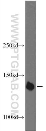 PHF20 Antibody in Western Blot (WB)