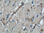 VAT1 Antibody in Immunohistochemistry (Paraffin) (IHC (P))