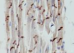 N-cadherin Antibody in Immunohistochemistry (Paraffin) (IHC (P))