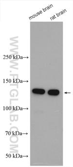 N-cadherin Antibody in Western Blot (WB)