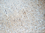 N-cadherin Antibody in Immunohistochemistry (Paraffin) (IHC (P))