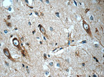 N-cadherin Antibody in Immunohistochemistry (Paraffin) (IHC (P))