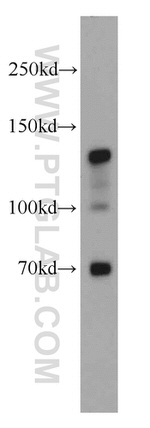 N-cadherin Antibody in Western Blot (WB)