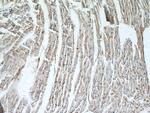 N-cadherin Antibody in Immunohistochemistry (Paraffin) (IHC (P))