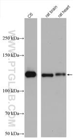 N-cadherin Antibody in Western Blot (WB)