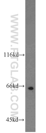 TERF2 Antibody in Western Blot (WB)