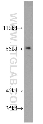 TERF2 Antibody in Western Blot (WB)