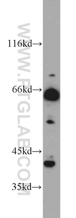 TERF2 Antibody in Western Blot (WB)