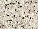 TERF2 Antibody in Immunohistochemistry (Paraffin) (IHC (P))