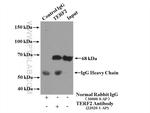 TERF2 Antibody in Immunoprecipitation (IP)