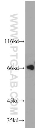 TERF2 Antibody in Western Blot (WB)