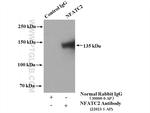 NFATC2 Antibody in Immunoprecipitation (IP)