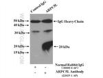 ARPC5L Antibody in Immunoprecipitation (IP)