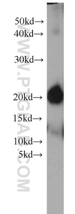 ARPC5L Antibody in Western Blot (WB)