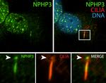 NPHP3 Antibody in Immunocytochemistry (ICC/IF)