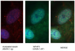 NPHP3 Antibody in Immunocytochemistry (ICC/IF)