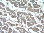 NPHP3 Antibody in Immunohistochemistry (Paraffin) (IHC (P))