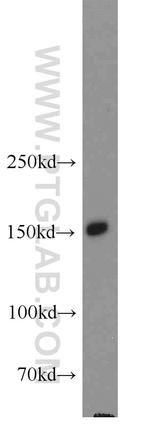 NPHP3 Antibody in Western Blot (WB)