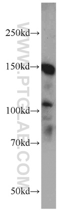 NPHP3 Antibody in Western Blot (WB)