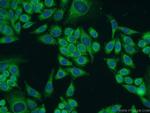 PIK3C2A Antibody in Immunocytochemistry (ICC/IF)