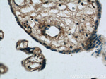 PIK3C2A Antibody in Immunohistochemistry (Paraffin) (IHC (P))