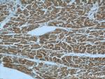 PIK3C2A Antibody in Immunohistochemistry (Paraffin) (IHC (P))