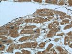 PIK3C2A Antibody in Immunohistochemistry (Paraffin) (IHC (P))