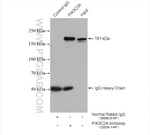 PIK3C2A Antibody in Immunoprecipitation (IP)