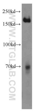 PIK3C2A Antibody in Western Blot (WB)