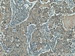 Hexokinase 2 Antibody in Immunohistochemistry (Paraffin) (IHC (P))