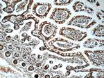 iPLA2 Antibody in Immunohistochemistry (Paraffin) (IHC (P))