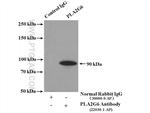 iPLA2 Antibody in Immunoprecipitation (IP)