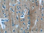 iPLA2 Antibody in Immunohistochemistry (Paraffin) (IHC (P))