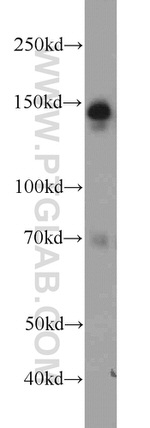 AHI1 Antibody in Western Blot (WB)