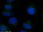 CEP97 Antibody in Immunocytochemistry (ICC/IF)