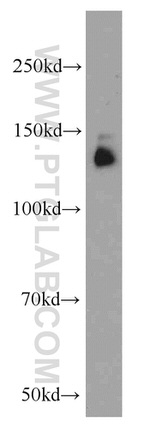 CEP97 Antibody in Western Blot (WB)