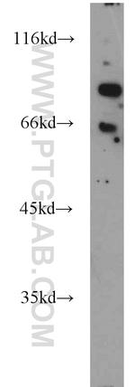 FOXP1 Antibody in Western Blot (WB)